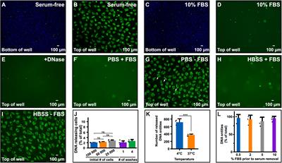 Sizing Up Extracellular DNA: Instant Chromatin Discharge From Cells When Placed in Serum-Free Conditions